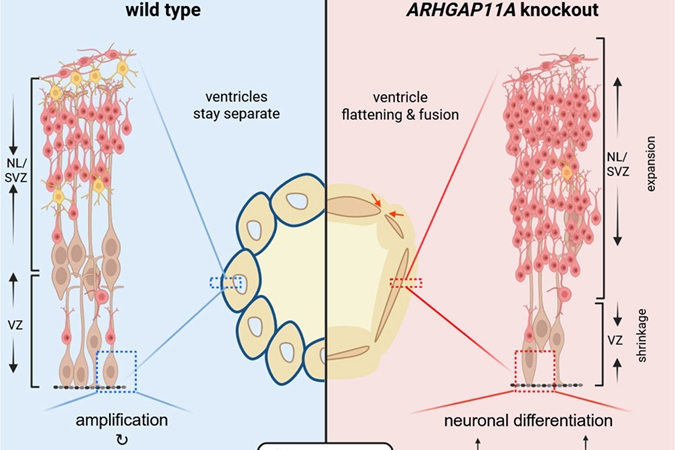 نقش یک ژن در معماری مغز انسان